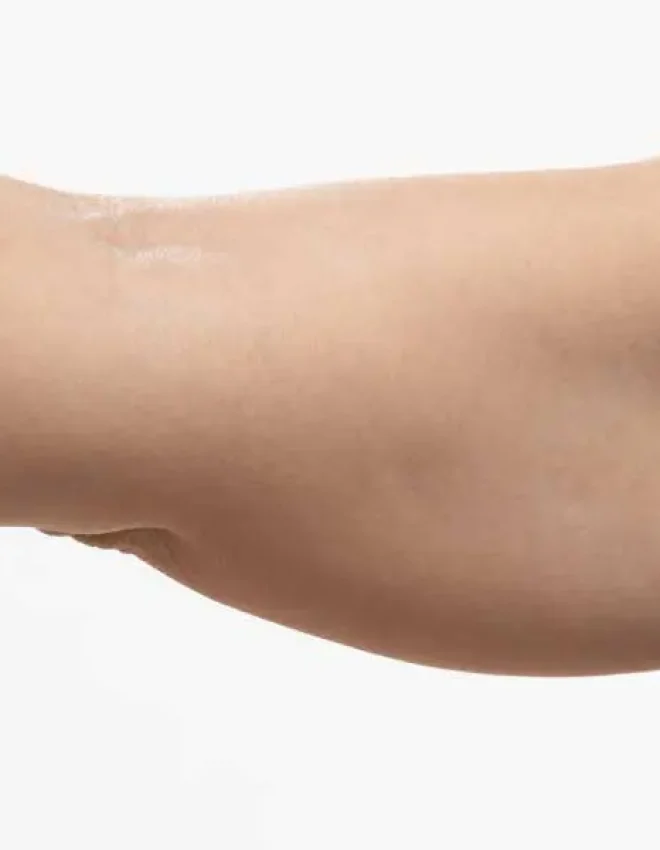 Arm Fat Overtakes All Other Concerns as Top Reason Singapore Women Seek Body Sculpting Consultations, Clinic Data Shows
