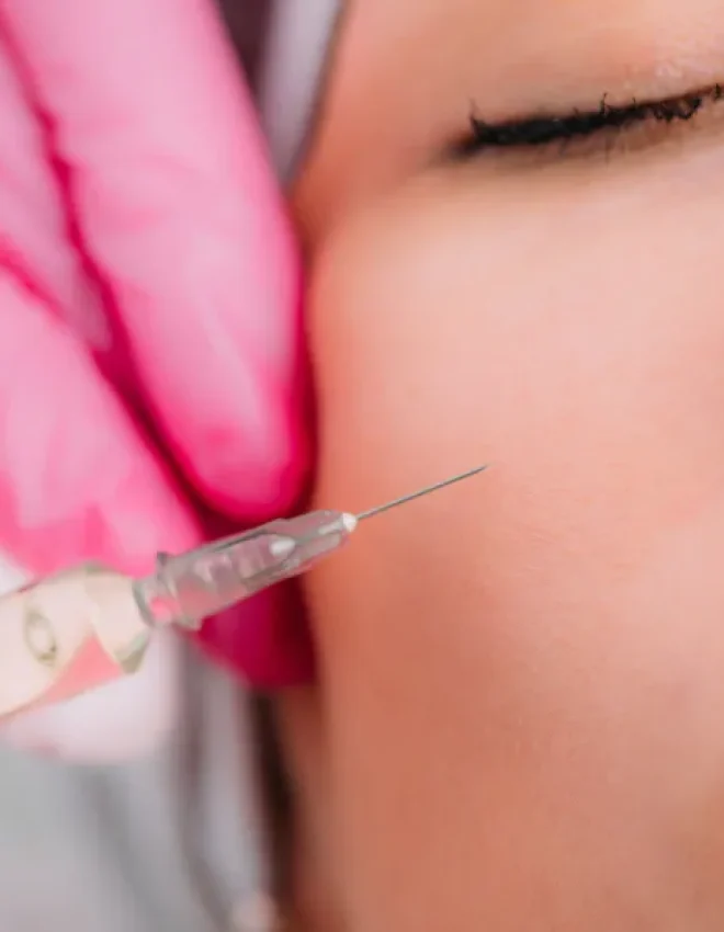 6 Months or Years? Fillers vs Fat Grafting, Explained by a Doctor