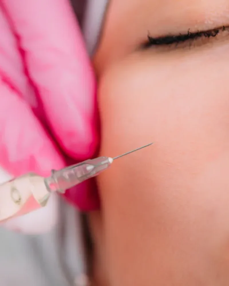6 Months or Years? Fillers vs Fat Grafting, Explained by a Doctor