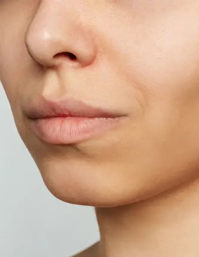 Buccal Fat Surgery: Why it bears risks and long-term consequences