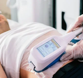 Fixing gynecomastia with fat freezing is a bad idea. Here’s why