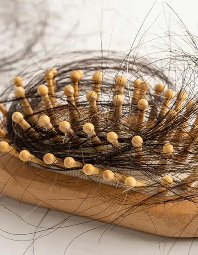 Hair Loss, Hair Thinning And Hair Breakage In Men & Women